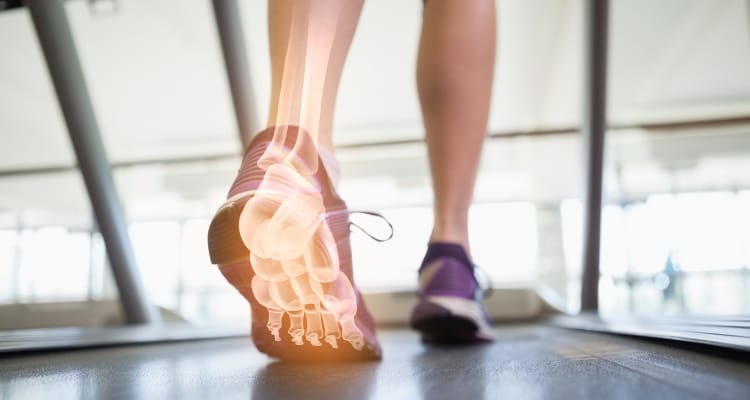 plantar-fasciitis_OMTimes