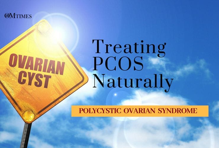 Treating PCOS Naturally