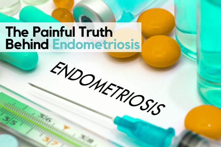 Endometriosis